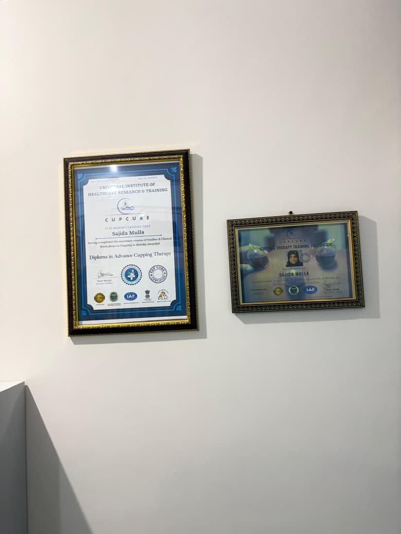Hijama Therapy Image 2